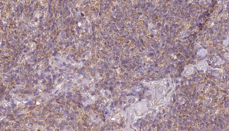 Polyclonal Rabbit anti-Human ACAA1 Antibody (IHC, WB)
