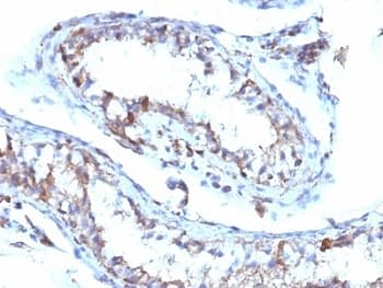 MSN / Moesin Antibody (clone MSN/493)