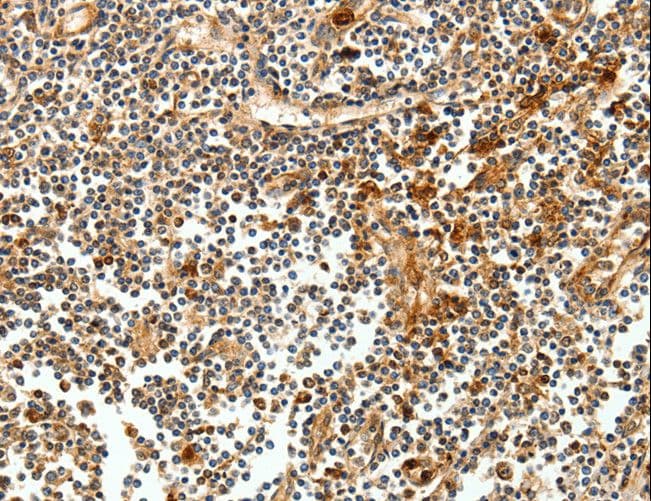 CEACAM21 Antibody