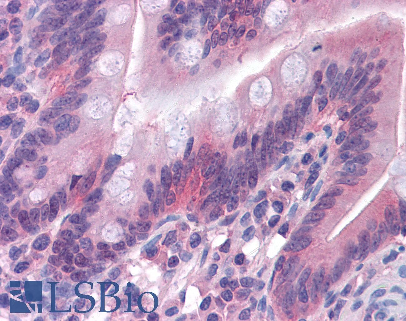 IHC-plus™ Monoclonal Mouse anti-Human Gasdermin D / GSDMD Antibody (clone 3F12-1B2, IHC, IF)