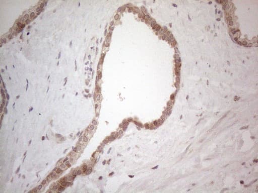 Monoclonal Mouse anti-Human BTBD10 / GMRP-1 Antibody (clone OTI7D3, IHC, WB)