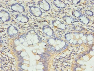 CCDC57 Antibody (Coiled-coil domain)
