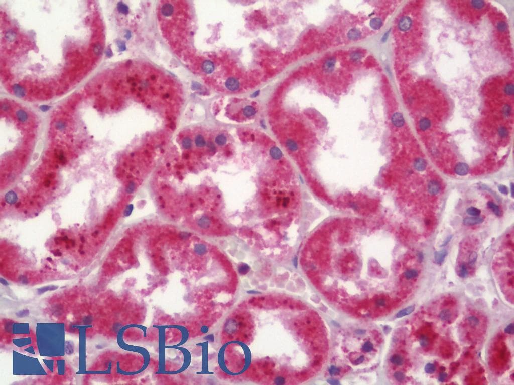 IHC-plus™ NDUFS6 Antibody (aa75-124)