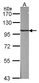 Polyclonal Rabbit anti-Human AP2B1 Antibody (aa384-609, WB)