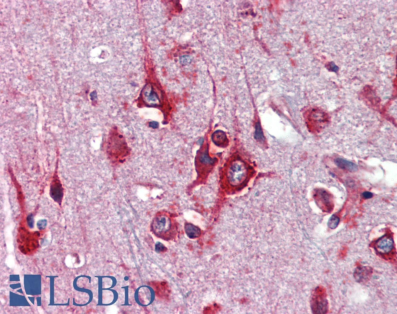 TFAP2C / AP2 Gamma Antibody (aa252-301)