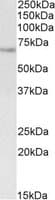 IHC-plus™ Polyclonal Goat anti-Human UBASH3A / CLIP4 Antibody (aa470-482, IHC, WB)