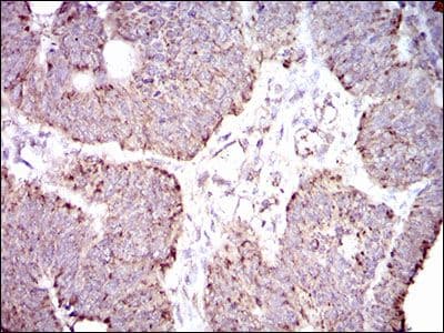 Monoclonal Mouse anti-Human ALDH2 Antibody (clone 4G6A3, Amino Acid: 317-517, IHC, IF, WB)
