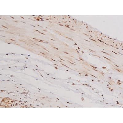 Polyclonal Rabbit anti-Human c-Kit / CD117 Antibody (IHC, IF, WB)