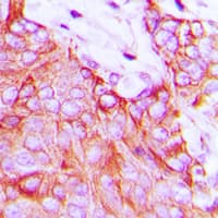 Polyclonal Rabbit anti-Human EFNA5 / Ephrin A5 Antibody (Internal, IHC, IF, WB)