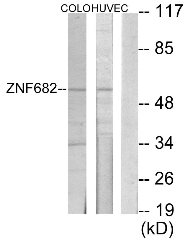 Polyclonal Rabbit anti-Human ZNF682 Antibody (aa21-70, WB)