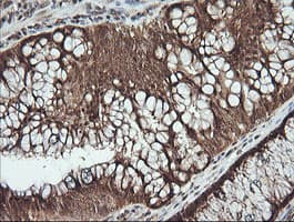 FAK / Focal Adhesion Kinase Antibody (clone OTI4G7)