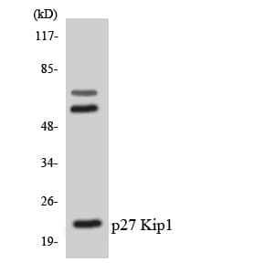 Polyclonal Rabbit anti-Human CDKN1B / p27 Kip1 Antibody (aa142-191, WB)
