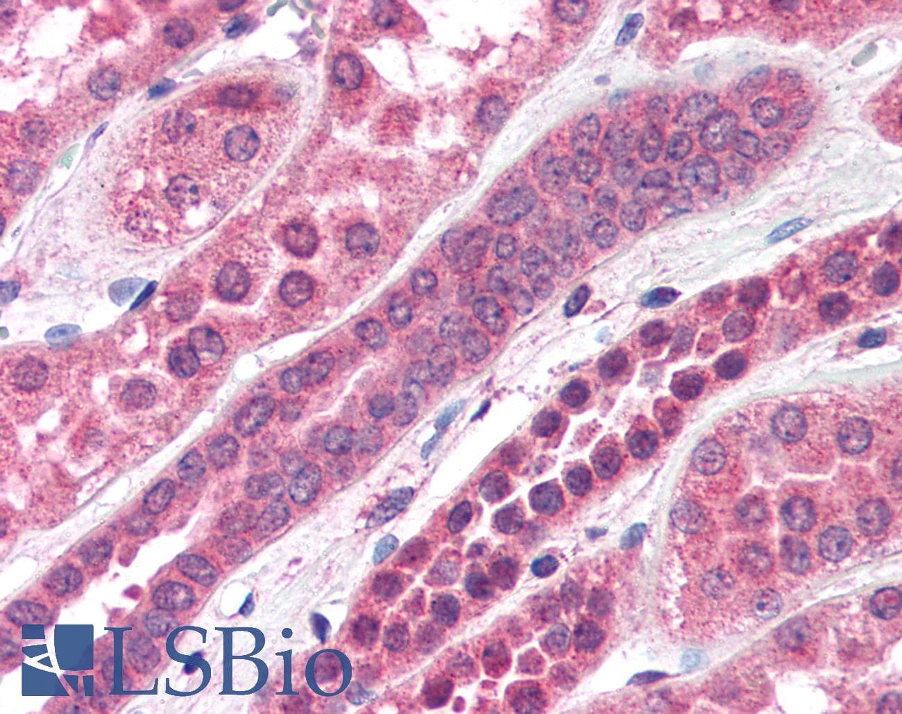 IHC-plus™ Amisyn / STXBP6 Antibody (aa2-14)