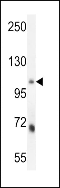 IHC-plus™ Polyclonal Rabbit anti-Human MLXIP / MONDOA Antibody (aa72-100, IHC, WB)