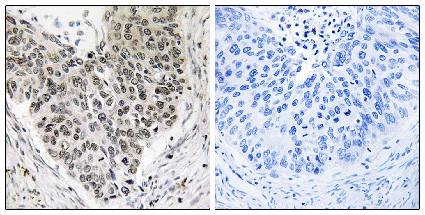 Polyclonal Rabbit anti-Human CARF / ALS2CR8 Antibody (IHC, WB)