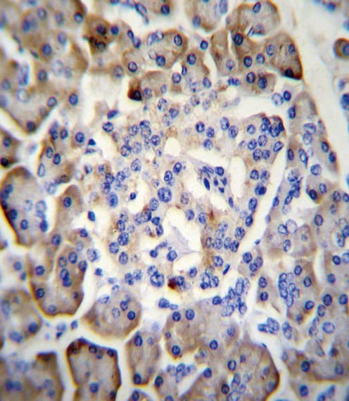 MDK / Midkine Antibody (aa113-143)