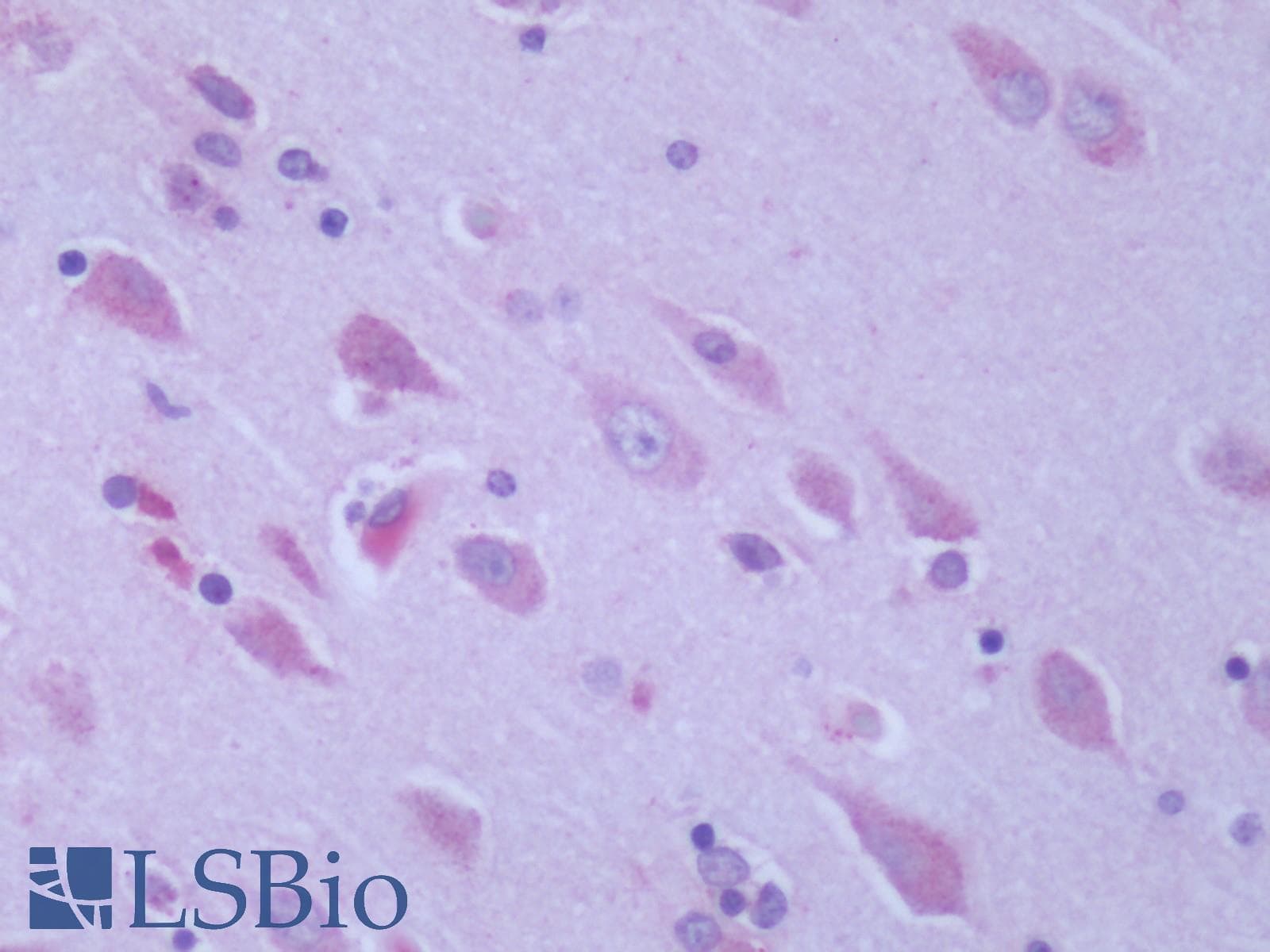 PathPlus™ Polyclonal Rabbit anti-Human GPR6 Antibody (Cytoplasmic Domain, IHC)