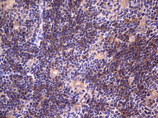 DOT1L / DOT1 Antibody (aa1-434, clone OTI1D8)