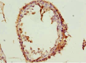 SPIN / SPIN1 Antibody