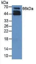 Collagen X Antibody (aa547-680)