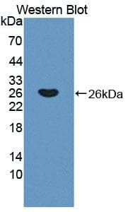 TNNI2 Antibody (aa1-182)