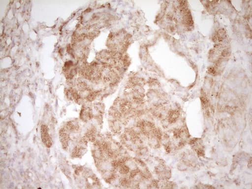 Monoclonal Mouse anti-Human PELI1 / Pellino 1 Antibody (clone OTI1D9, aa1-245, IHC, WB)
