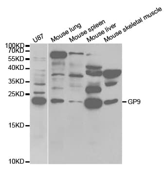 GP9 / CD42a Antibody