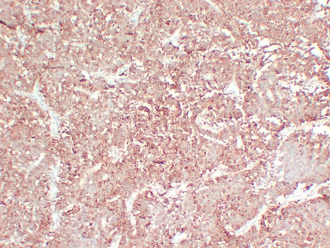 FSHB / FSH Beta Antibody (clone ABT-FSH)