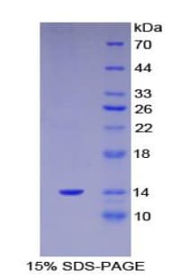 Human Calgizzarin / S100A11 Protein (Recombinant His)