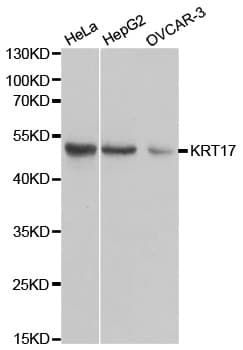 KRT17 / CK17 / Cytokeratin 17 Antibody