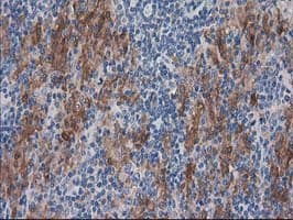 SULT1C2 / Sulfotransferase 1C2 Antibody (clone OTI4G1)