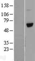 VTN / Vitronectin Protein (Over-Expression Lysate Myc-DDK (Flag))