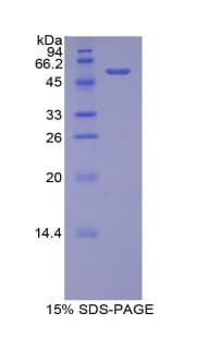 Rat PROC / Protein C (Recombinant His-GST)