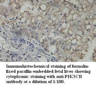 PIK3CB / PI3K Beta Antibody (aa627-917)