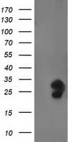 FGF21 Antibody (clone OTI4B4)