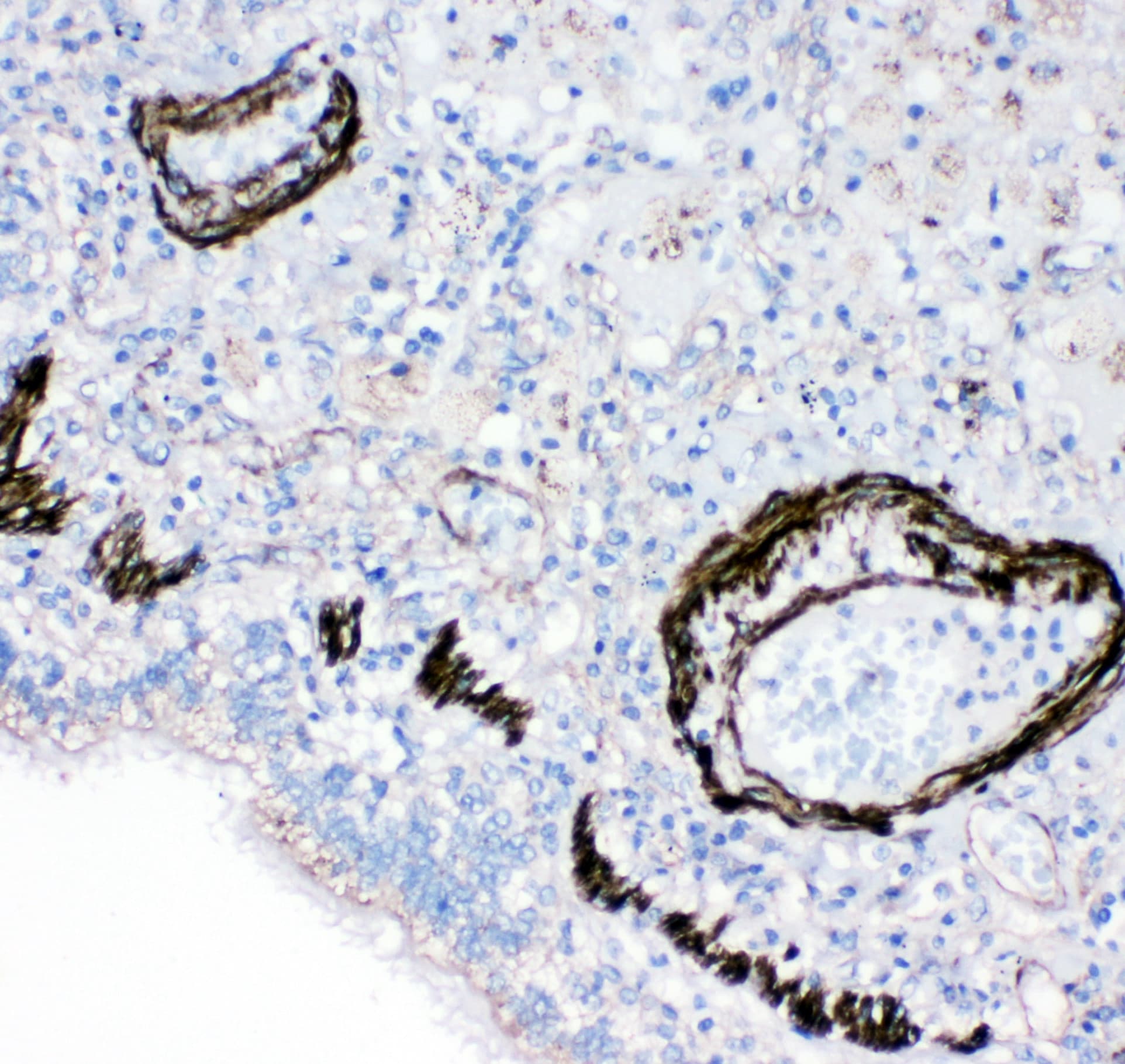 I-BABP / FABP6 Antibody (aa15-33)