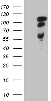 MAPT / Tau Antibody (aa623-758, clone OTI13B5)