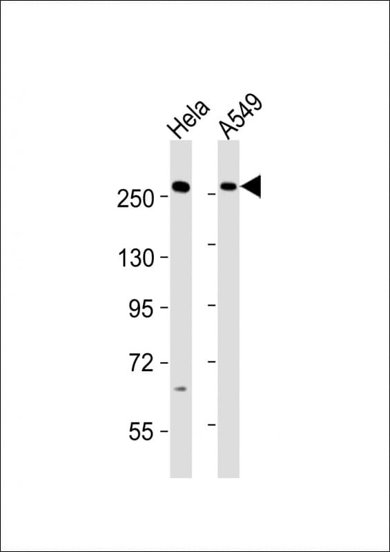 PLXNB1 / Plexin-B1 Antibody (aa1715-1749)