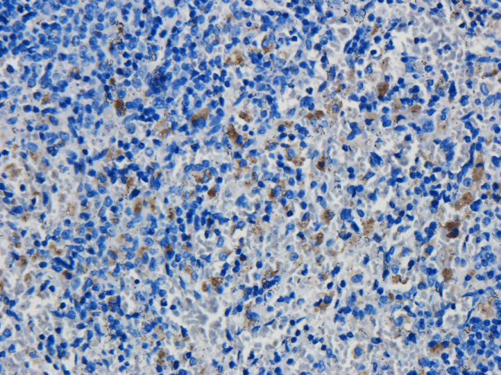 CD19 Antibody (CD19, clone FMC63)