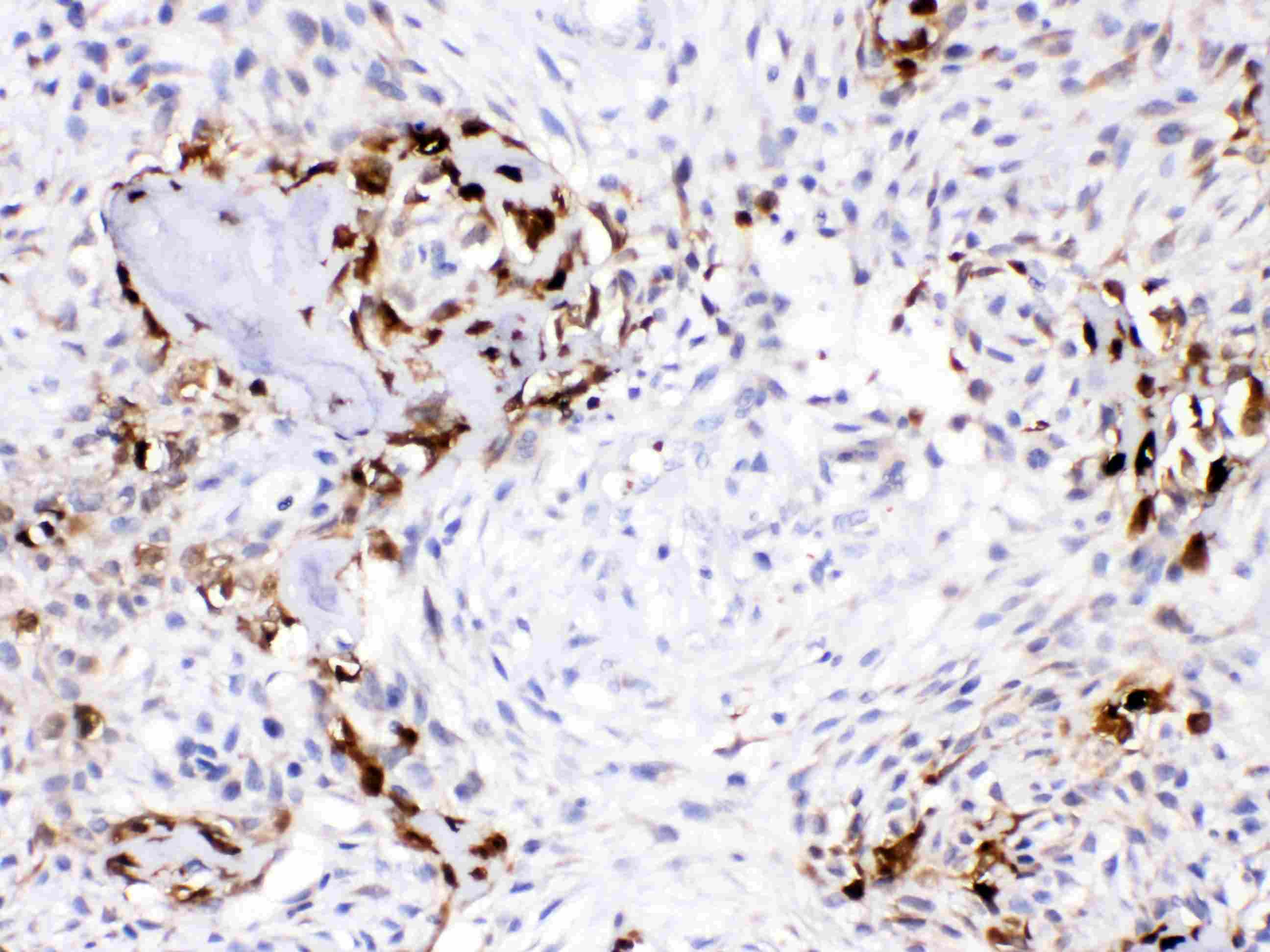 Polyclonal Rabbit anti-Human CA3 / Carbonic Anhydrase III Antibody (IHC, WB)