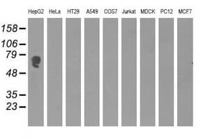 Monoclonal Mouse anti-Human Alpha-Fetoprotein Antibody (clone OTI3B5, WB)