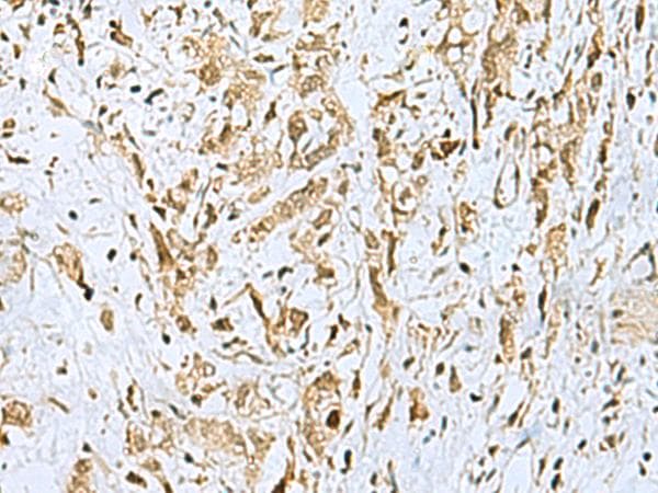 HOXC9 Antibody