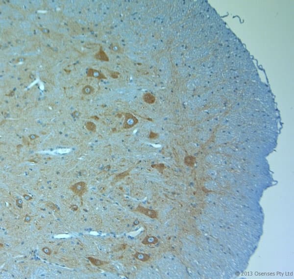 Polyclonal Rabbit anti-Human CLVS1 Antibody (aa300-354, IHC, WB)