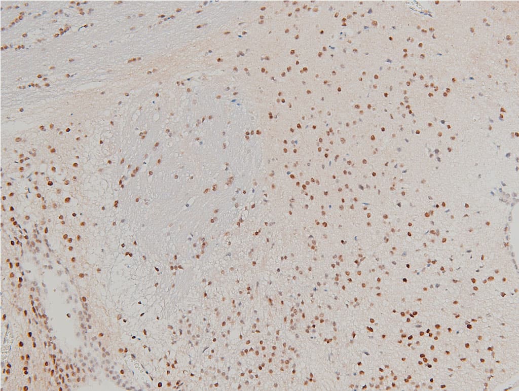 CFL1 / Cofilin Antibody (phospho-Ser3)