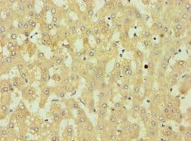 DKK4 Antibody (aa19-224)