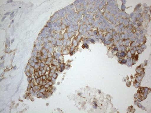 VAP33 / VAPA Antibody (aa2-227, clone OTI10E10, Carrier-free)