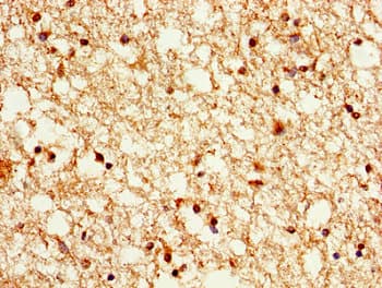HIST1H1B Antibody