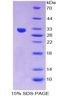 Mouse GCKR Protein (Recombinant His-T7)