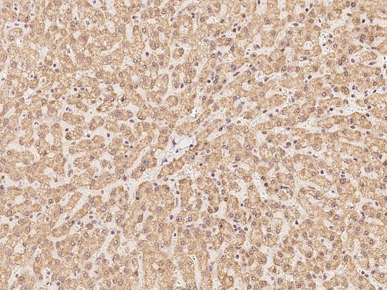 EXOSC2 / RRP4 Antibody