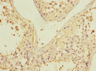 PGAM2 Antibody